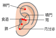 ダイエットの耳つぼ